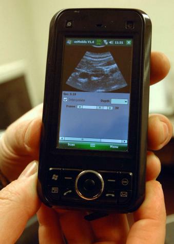 Smartphone met echoscoop