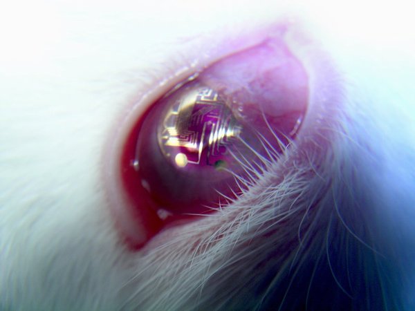 Bionische contactlens1