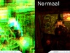 Artifacts vergeleken met normaal beeld.