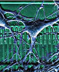 Neuro-chip