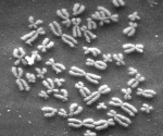 Chromosomen
