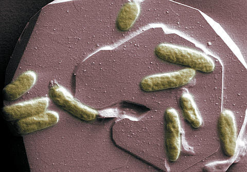 Shewanella oneidensis