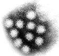 Virus