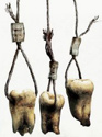 Saw III