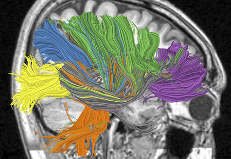 Cognitieve computer IBM hersenen Darpa