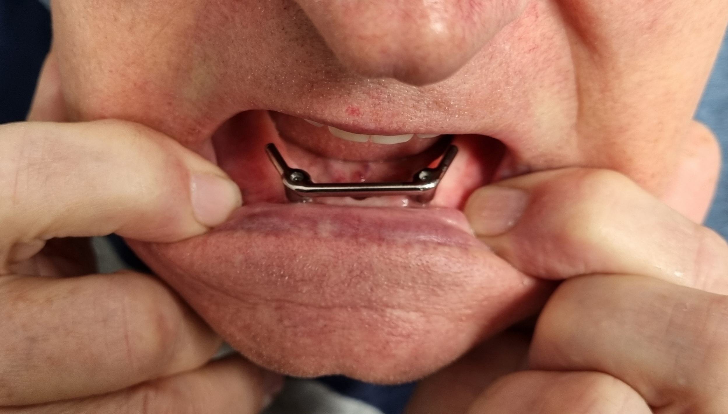 Afbeeldingslocatie: https://tweakers.net/fotoalbum/image/LxNcSkbSwK8fanxnZAjVwiXu.jpg