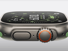 Apple Watch Series 11