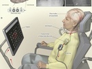 Brein-computer-interface ALS patiente