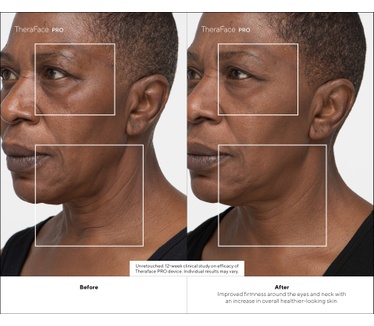 Therabody TheraFace PRO