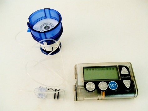 Een pomp van Medtronic