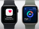Apple Watch Series 11