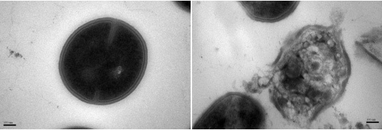 Mrsa-bacterie voor en na effect van nanodeeltjes Mrsa-bacterie voor en na effect van nanodeeltjes