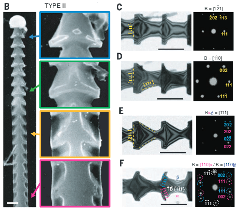 elektronenmicroscoop plaajes spicules mesomateriaal