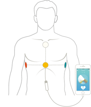 CardioSecur