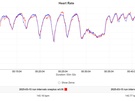 Oneplus Watch 3 hartslagdata