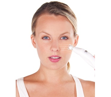 Lanaform Beauty Aspect