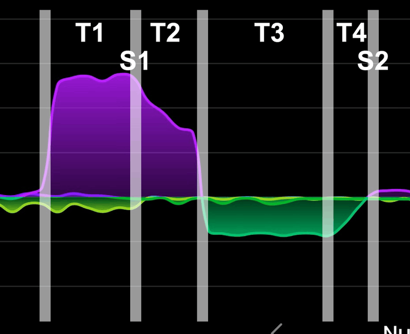 Afbeeldingslocatie: https://tweakers.net/i/dGXa_YJqS5Lx6N_BAHF7p1nALLM=/800x/filters:strip_exif()/f/image/1dTuggRy58Z1Sj2bFcBrEkmA.png?f=fotoalbum_large