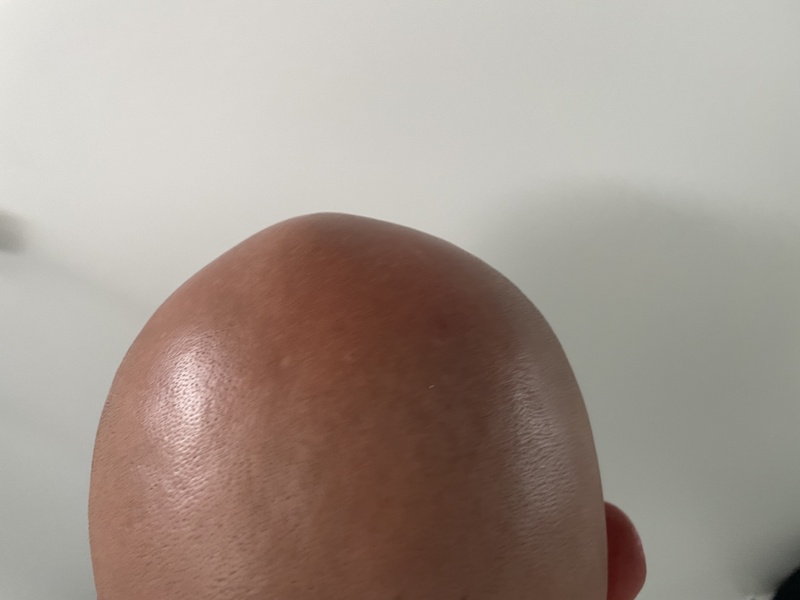 Afbeeldingslocatie: https://tweakers.net/i/kD8hYZ0ZD26kImkDtb1RflylQk4=/800x/filters:strip_icc():strip_exif()/f/image/3UNLg8aFwEAh8Pw9EHCwYbhF.jpg?f=fotoalbum_large