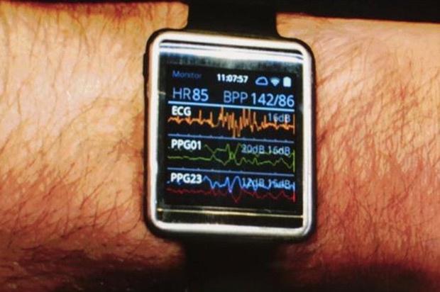 Samsung Simband