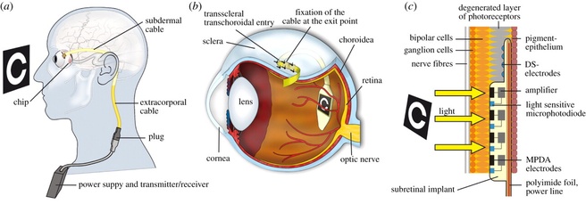 Retina-implantaat