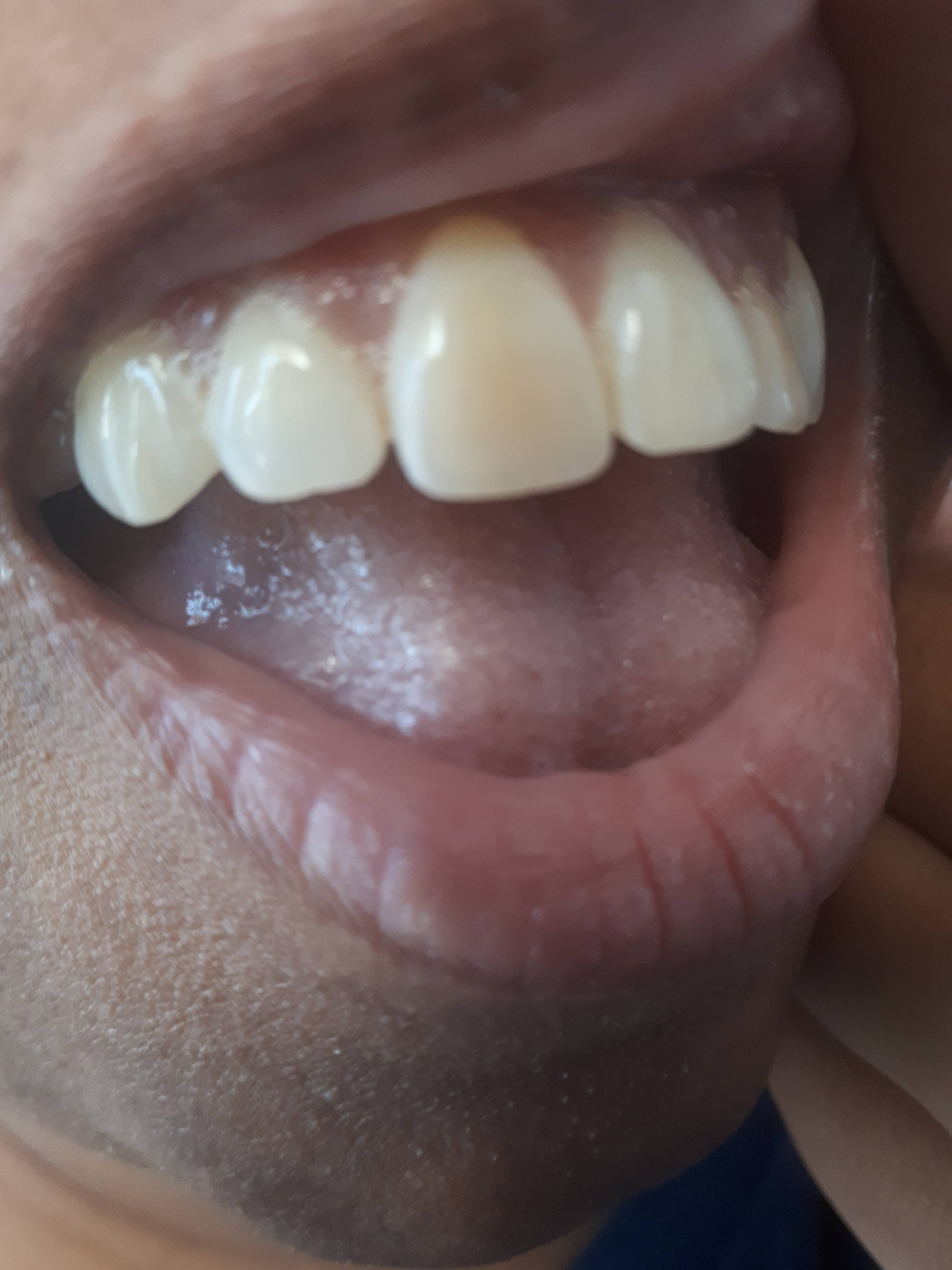 32xydRlQbGkAA9dVtNMSIITD.jpg?f=user_large