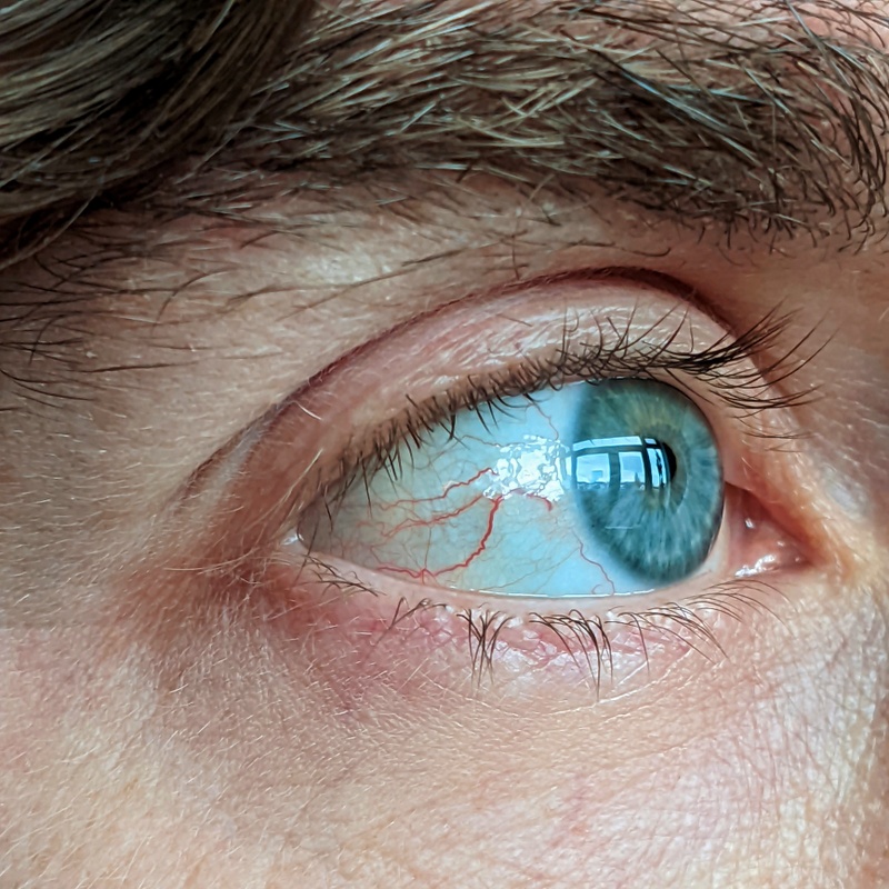 Afbeeldingslocatie: https://tweakers.net/i/wJ_1nfgYIYUNJm3KTXETWbei6tQ=/800x/filters:strip_icc():strip_exif()/f/image/Zk63wpMr3fx3h0La4yvSdZ1R.jpg?f=fotoalbum_large