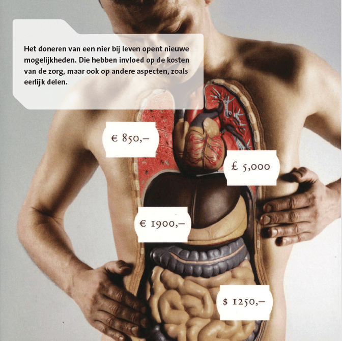 Afbeeldingslocatie: https://tweakers.net/i/yANM3GvwwBQzgY2otpwg13UREC8=/full-fit-in/4000x4000/filters:no_upscale():fill(white):strip_exif()/f/image/Shc3chWP7sj2z2DNMxjnSZbY.png?f=user_large