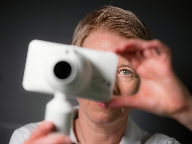 Dermatologie, huidkanker, huidkankerdetectie (beeld: UZGent)