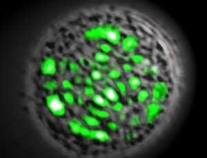 GFP fluorescente cel